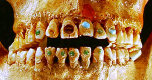 Ancient Mayan Bejewelled teeth