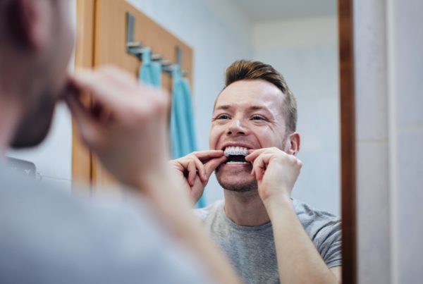 Man using at home teeth whitening tray