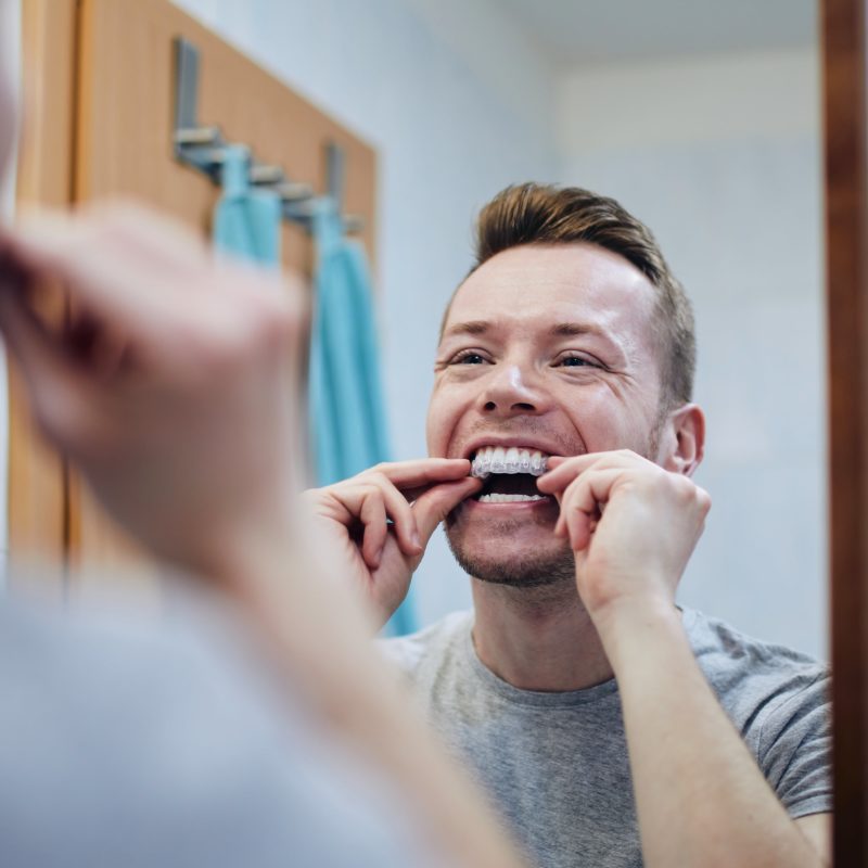 Man using at home teeth whitening tray