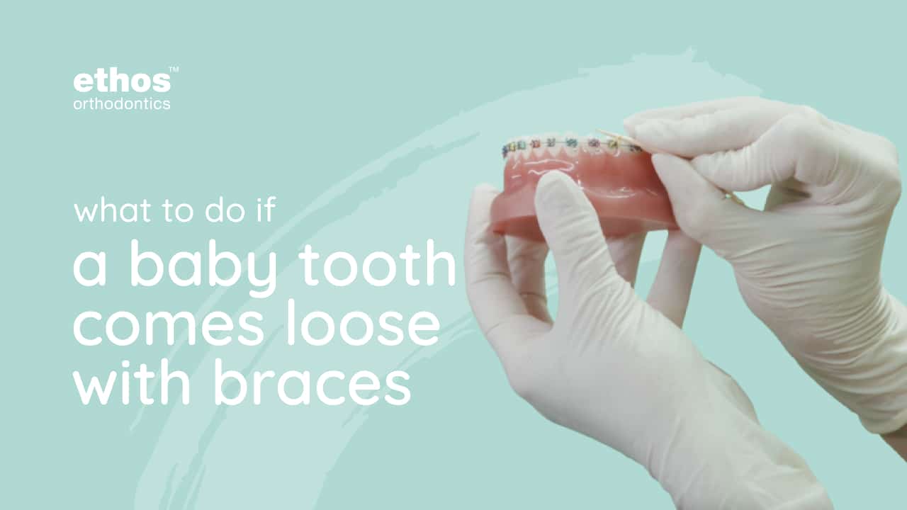 What to do if a baby tooth comes loose with braces