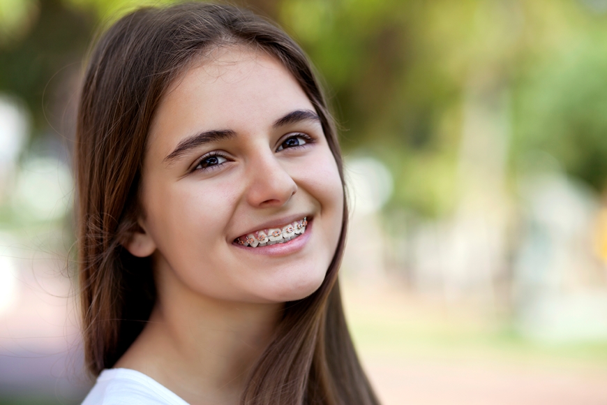 Cleaning Tips With Braces Ethos Orthodontics 