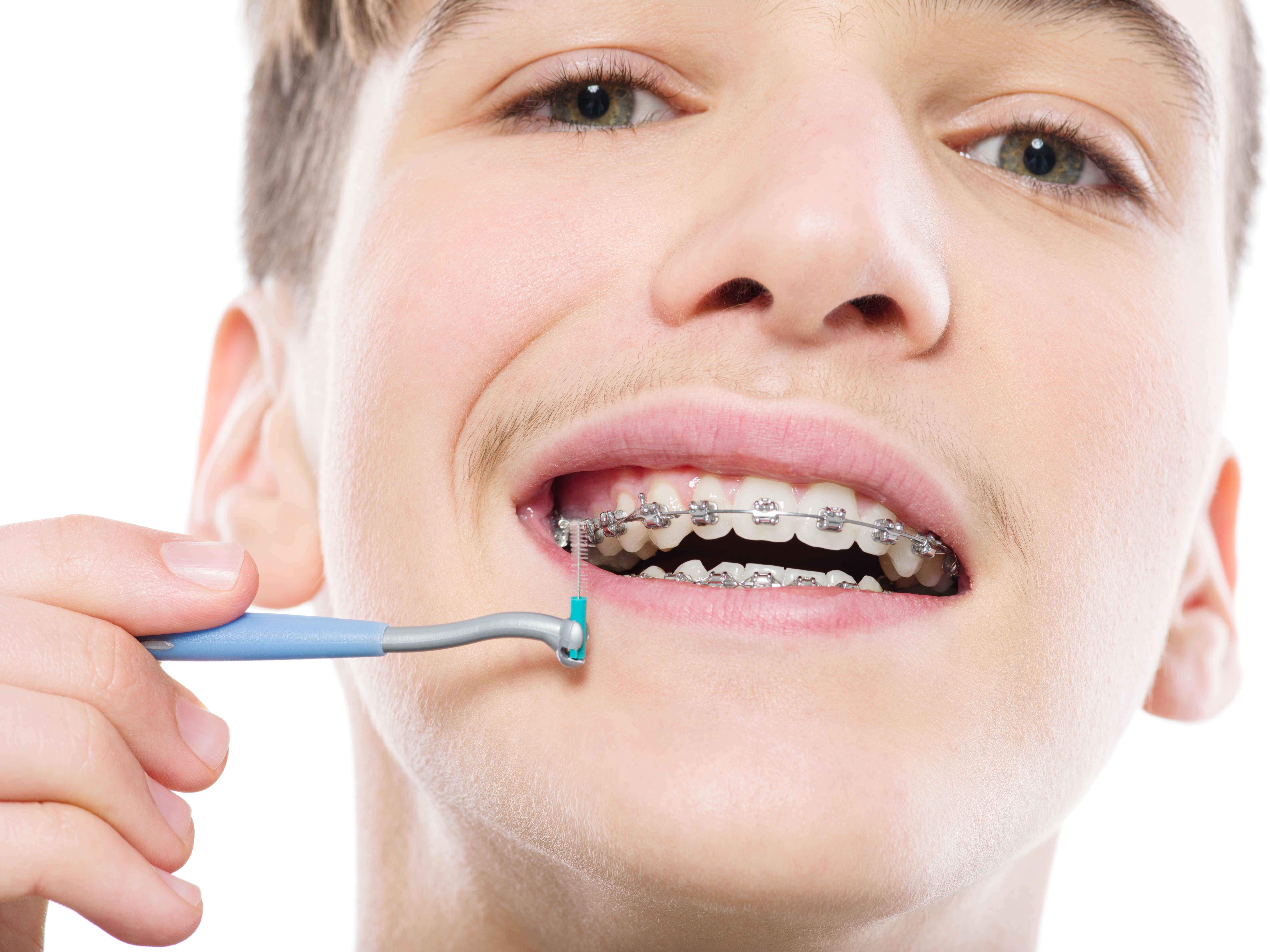 Teen boy flossing between his braces